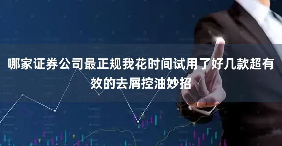 哪家证券公司最正规我花时间试用了好几款超有效的去屑控油妙招